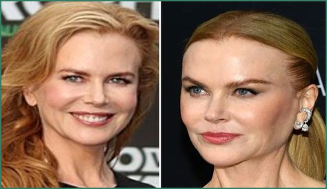 Nicole Kidman's 